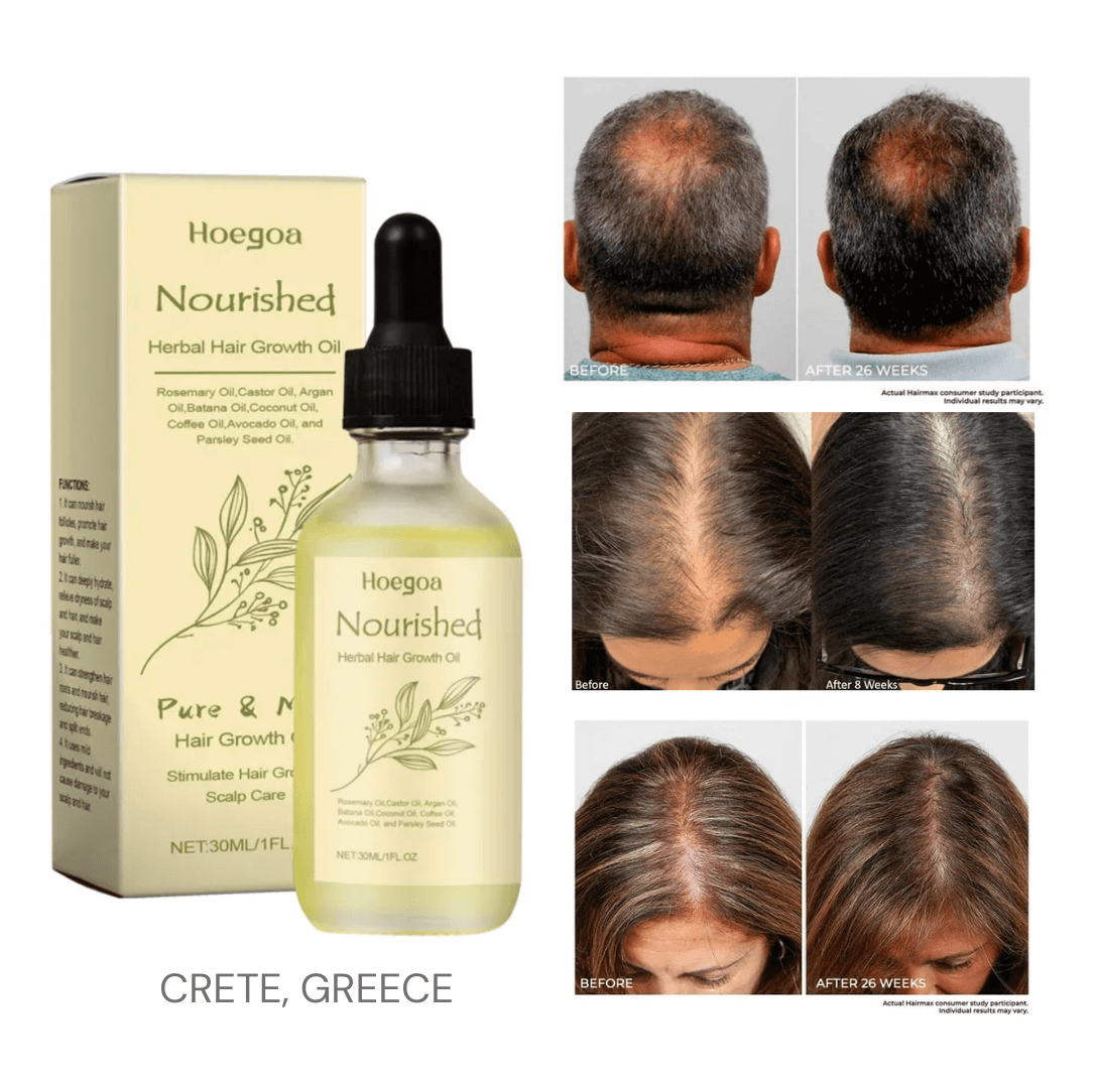 |Greece| #1 Hair growth oil (Rosemary oil, Castor Oil, Argan Oil, Batana oil, Coconut oil, Coffee oil, Avocado oil, Parsley seed oil....)